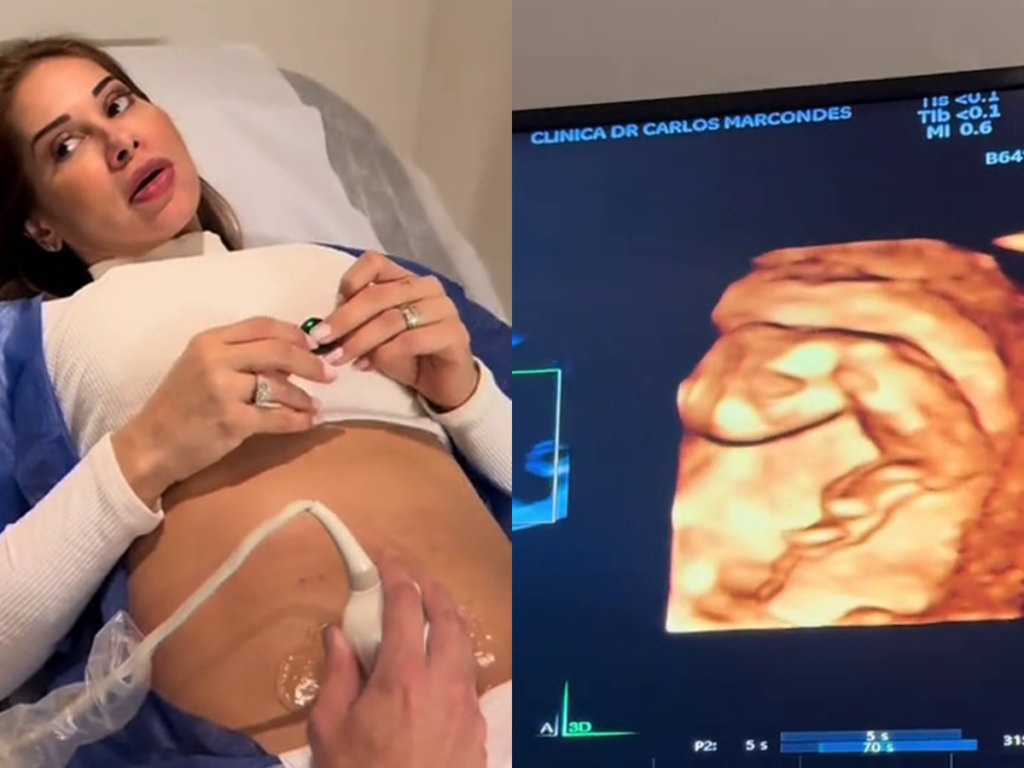maira-cardi-ultrassom.webp