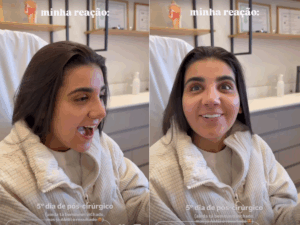 foto-yasmin-santos-reage-ao-ver-resultado-apos-rinoplastia-sou-outra-pessoa.png