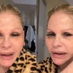 Monique Evans conta que passou por situação inusitada em banco durante recuperação de cirurgia facial
